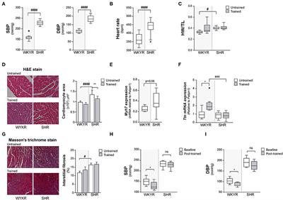 Moderate Exercise in Spontaneously Hypertensive Rats Is Unable to Activate the Expression of Genes Linked to Mitochondrial Dynamics and Biogenesis in Cardiomyocytes